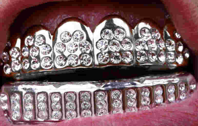 Are you sinking your teeth into shimmery dental grills?