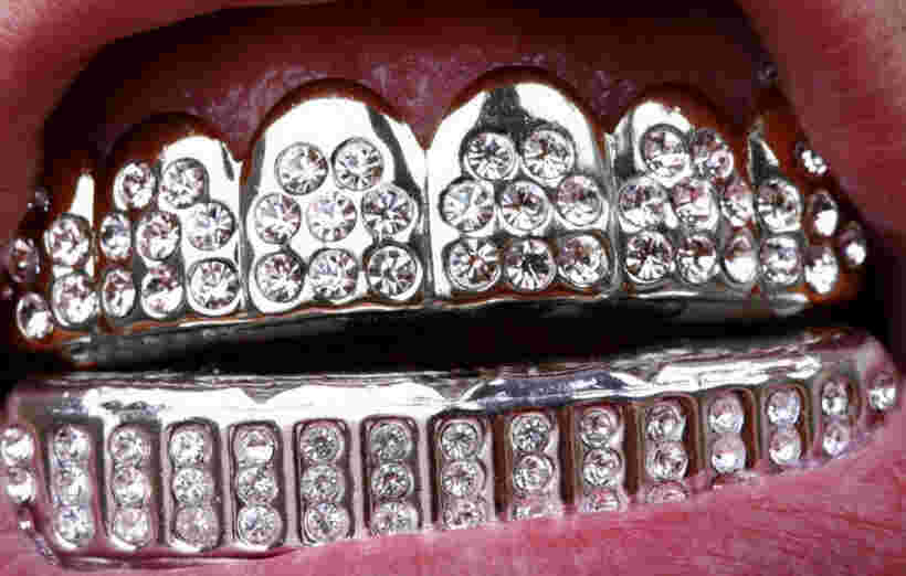 Are you sinking your teeth into shimmery dental grills?