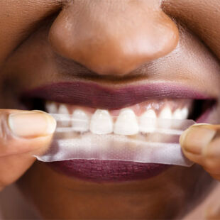 WhiteBlanc Teeth Whitening