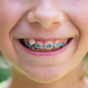 Braces & Orthodontic Care